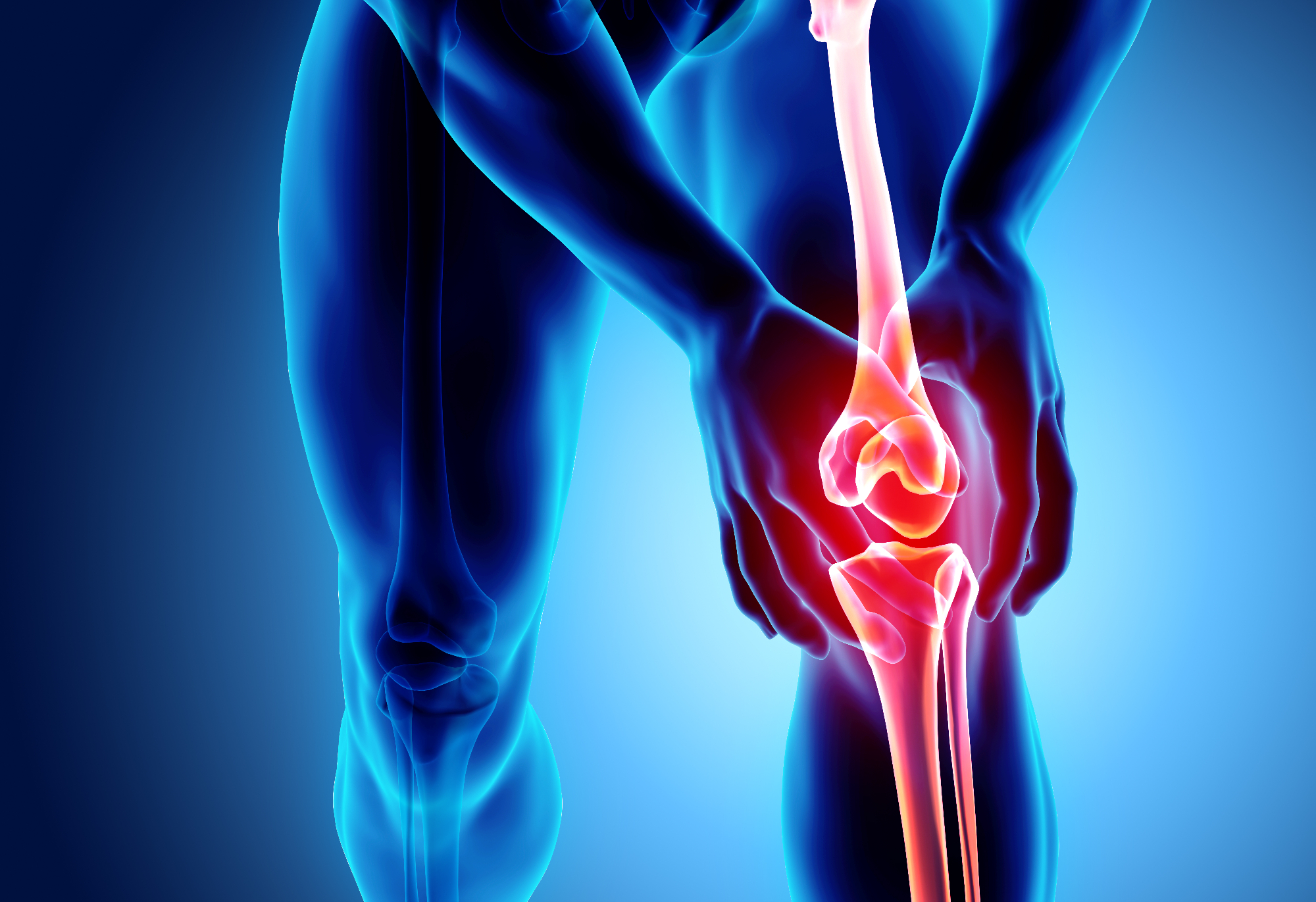 Artroza kolena je nekaj kar lahko hitro opazimo